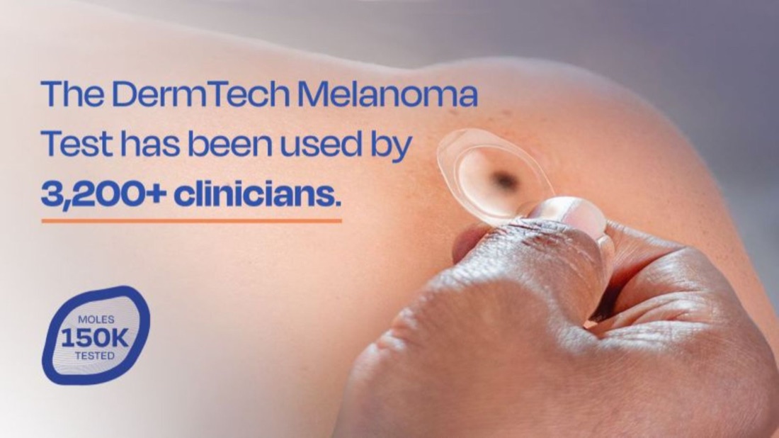 DermTech Melanoma Test ad noting it has been used by 3,200+ clinicians